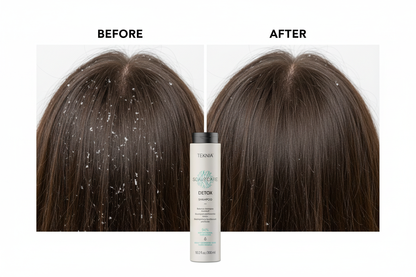 DETOX Dandruff Control Shampoo scalp before and after